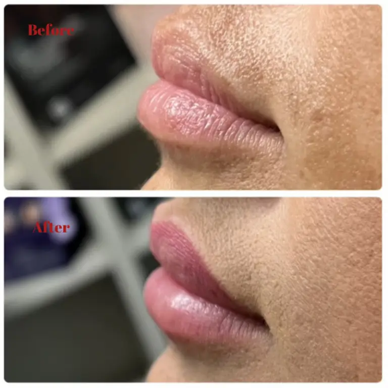 Before & After