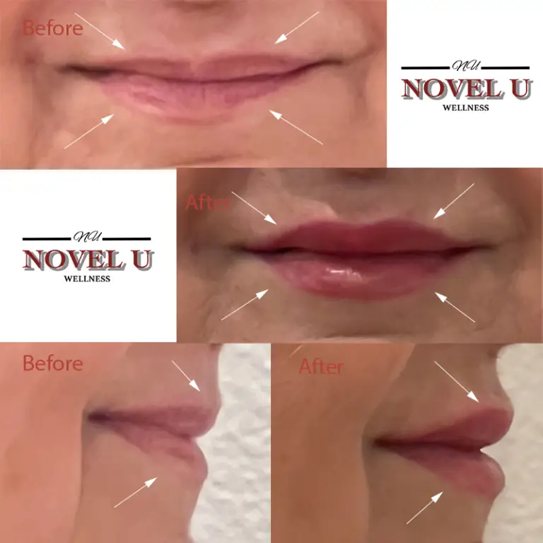 Before & After