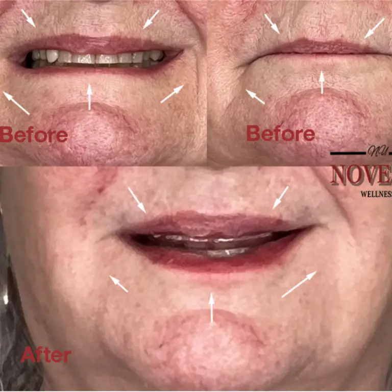 Before & After