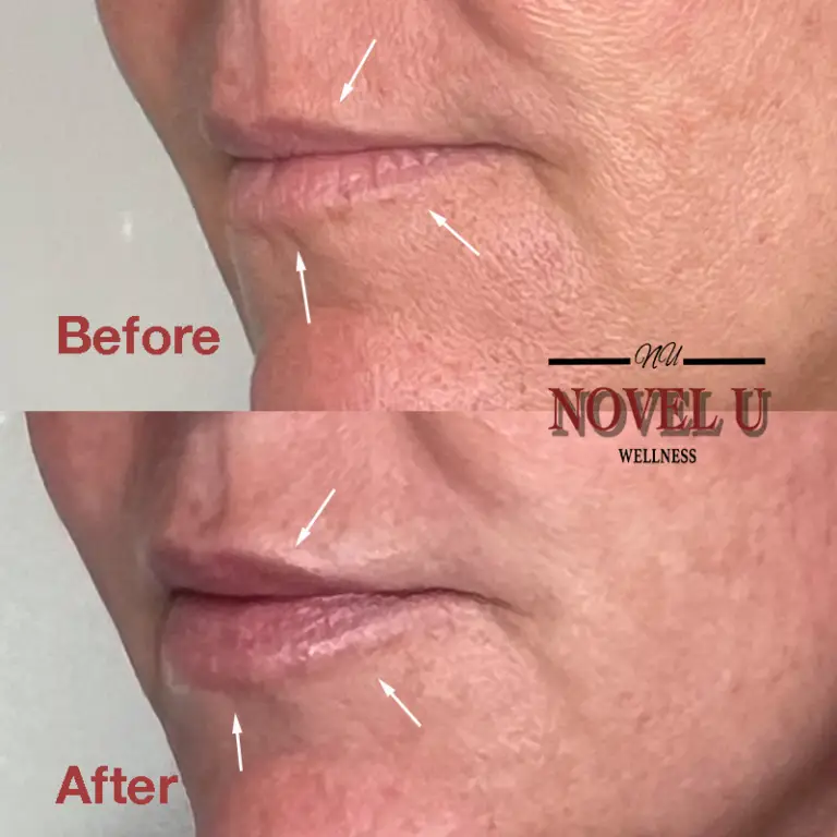 Before & After