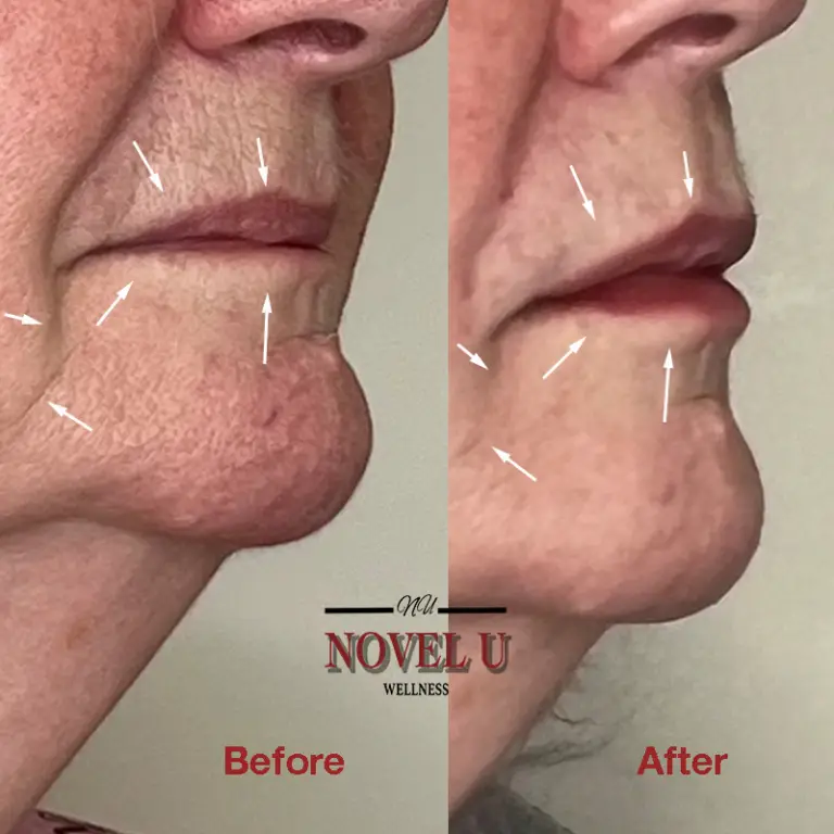 Before & After