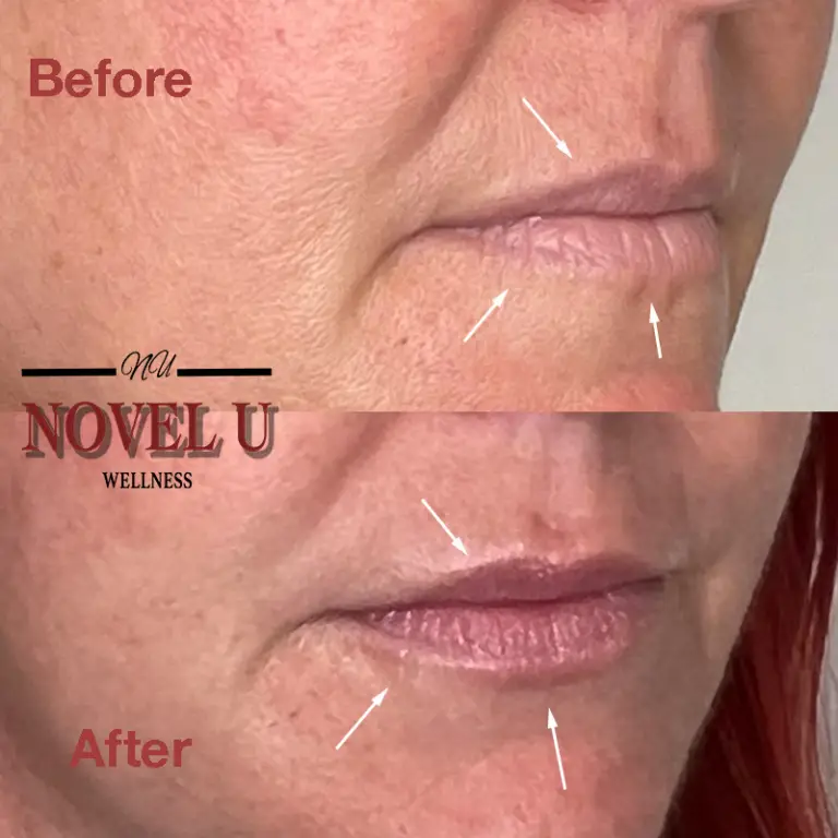 Before & After