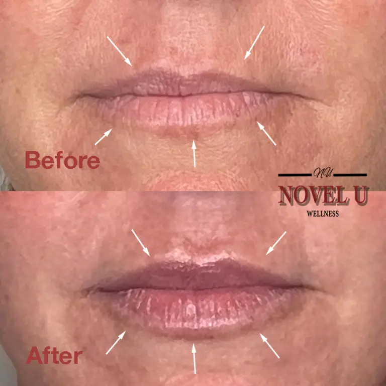 Before & After