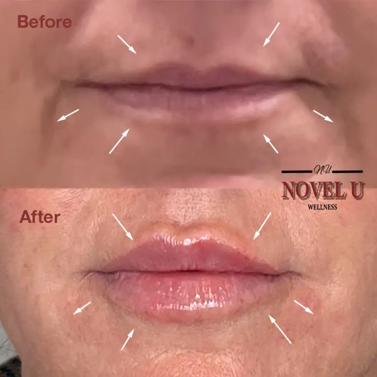 Before & After