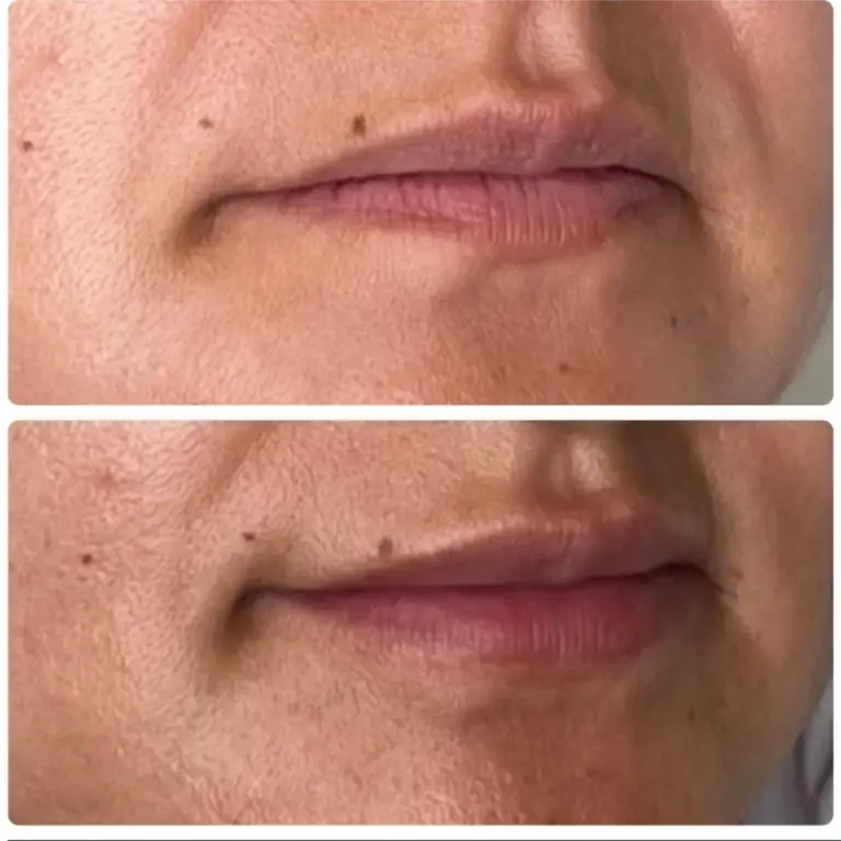 Before & After