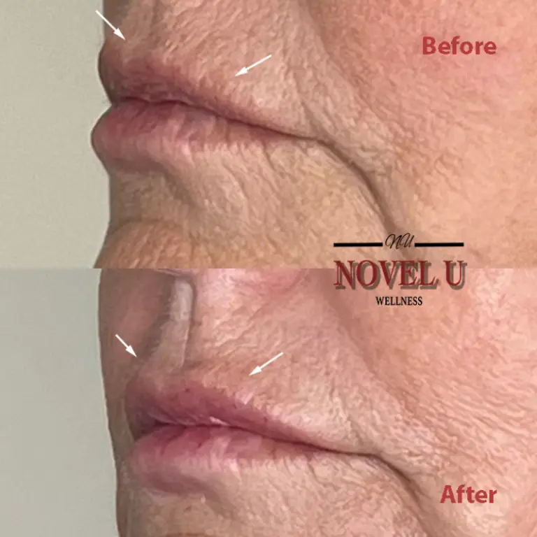Before & After