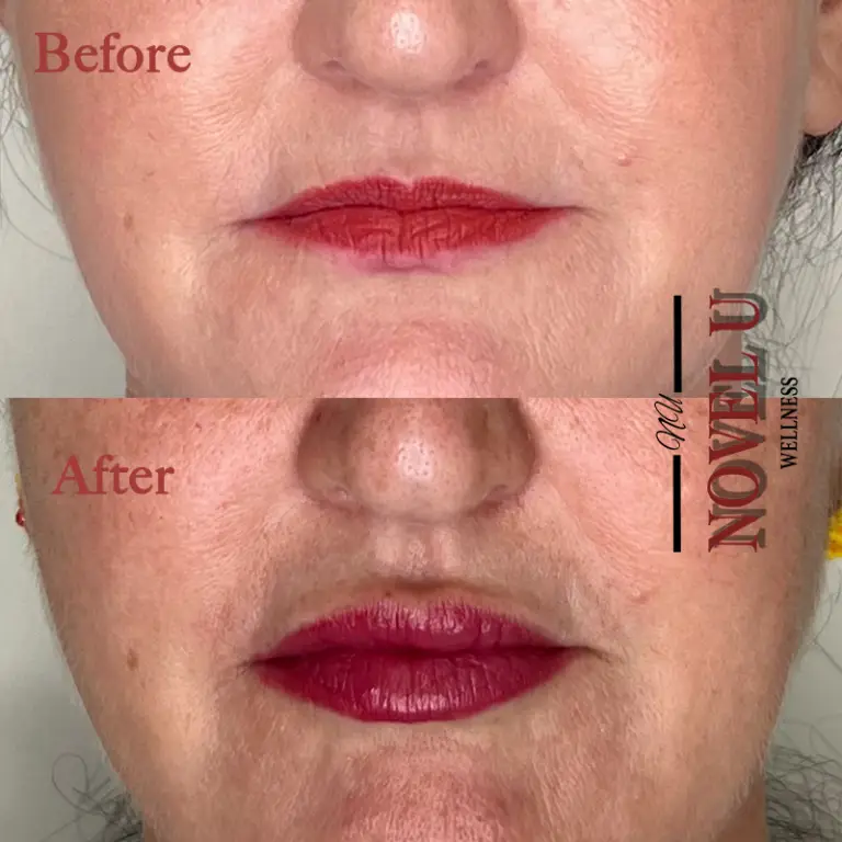 Before & After