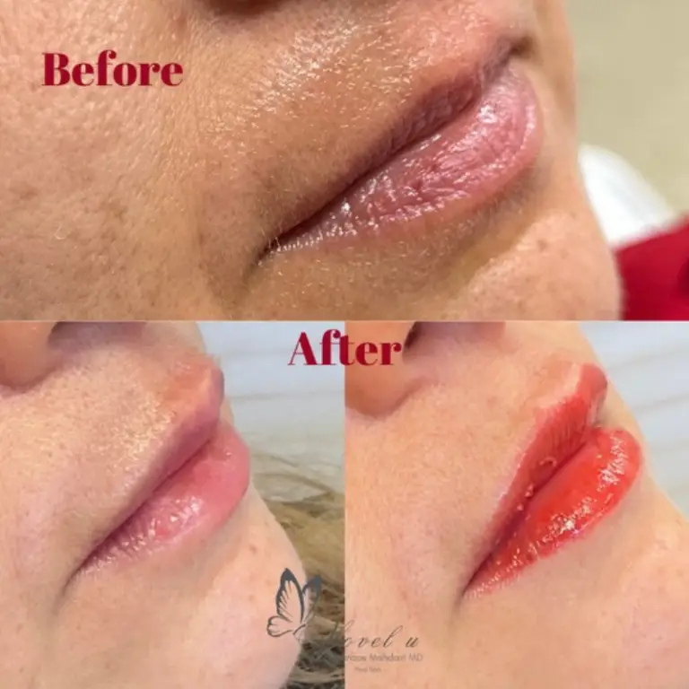 Before & After