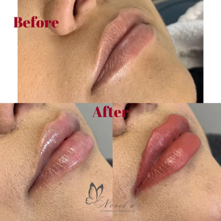 Before & After