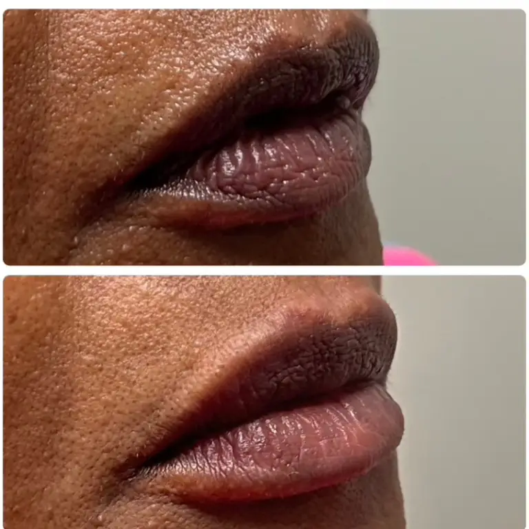 Before & After