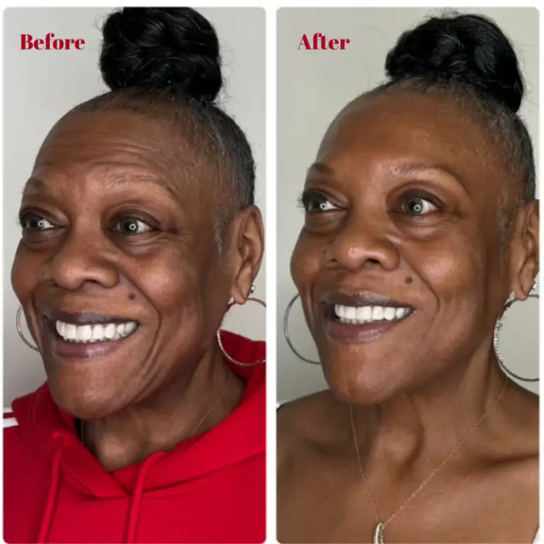 Before & After