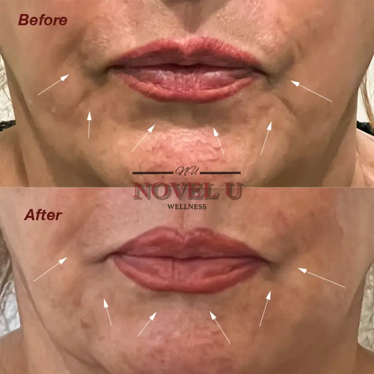 Before & After
