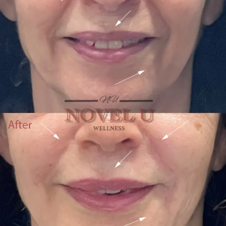 Before & After