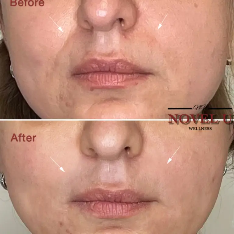 Before & After