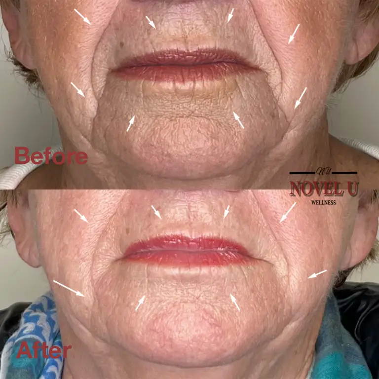 Before & After