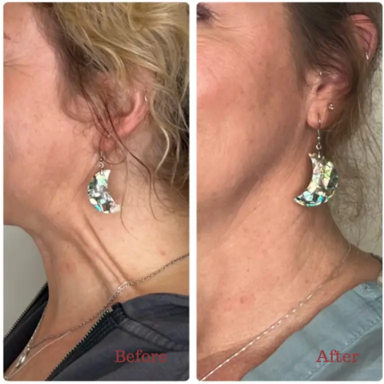 Before & After
