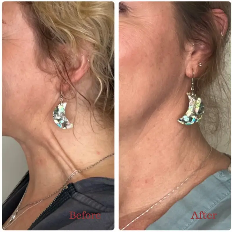 Before & After