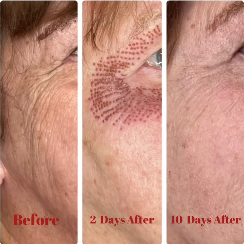 Before & After