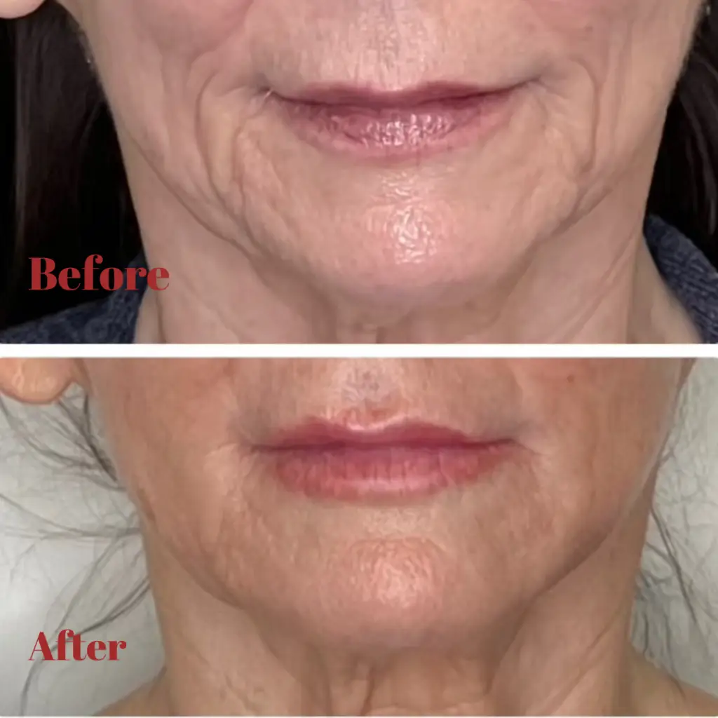 Before & After