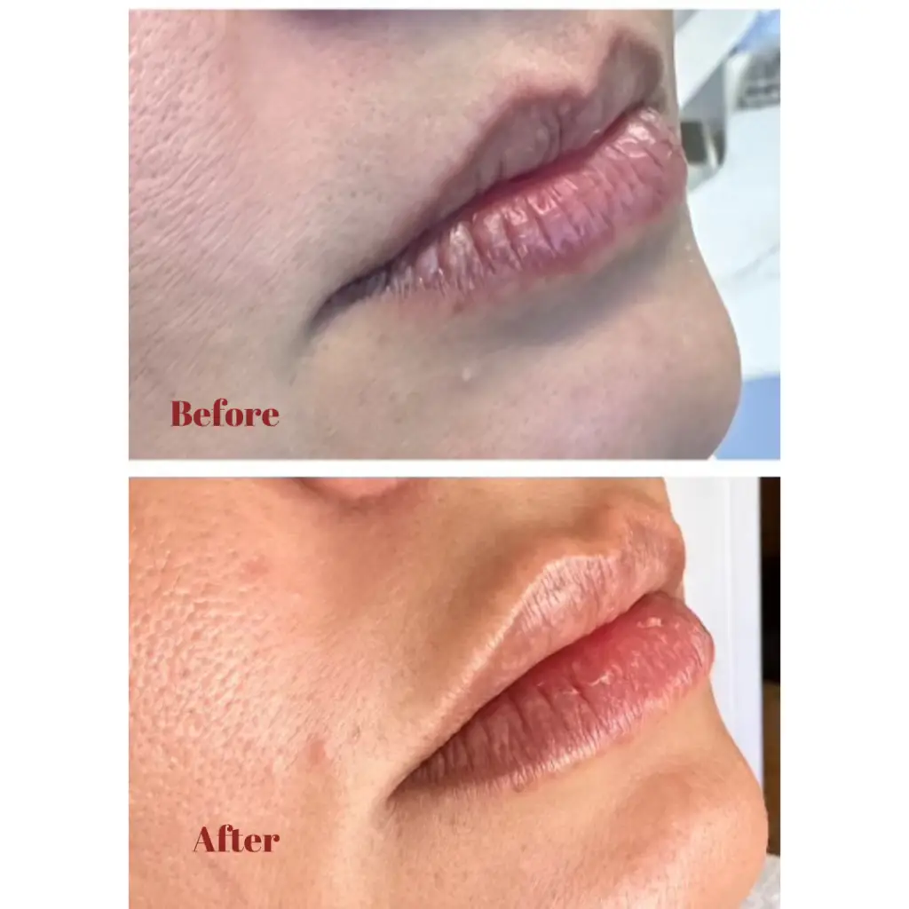 Before & After