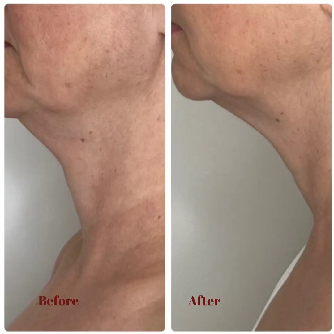 Before & After