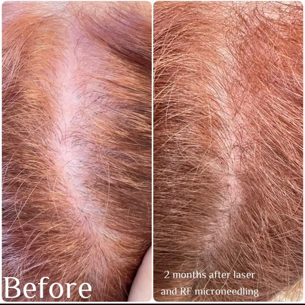 Before & After