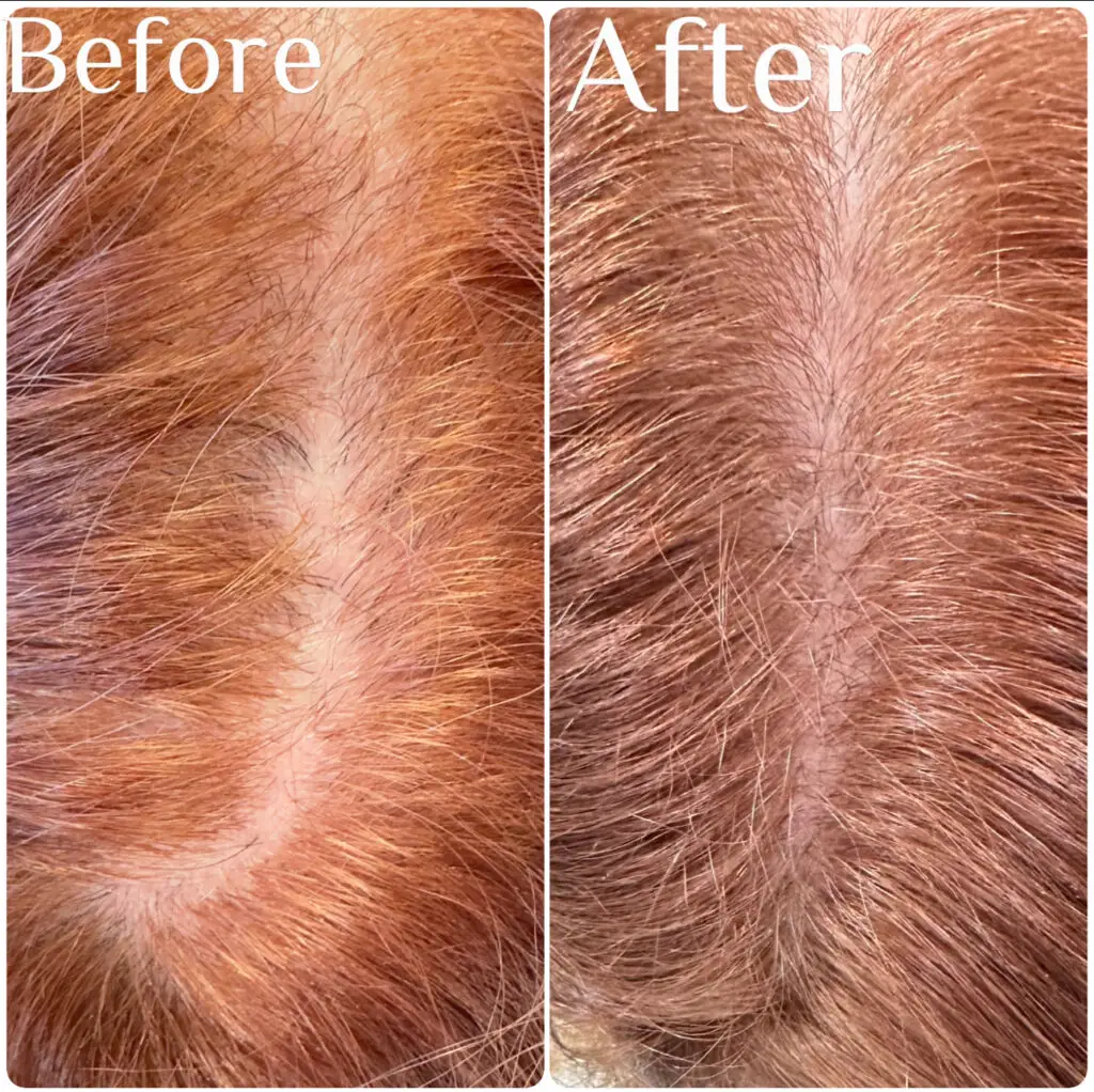 Before & After