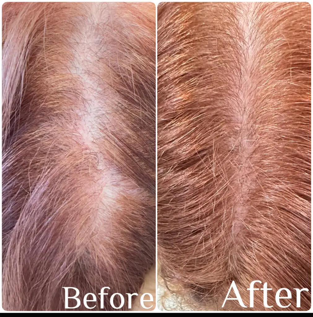 Before & After