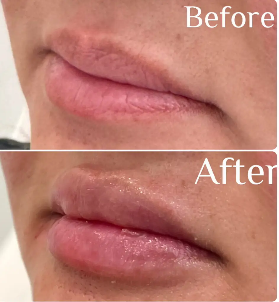 Before & After