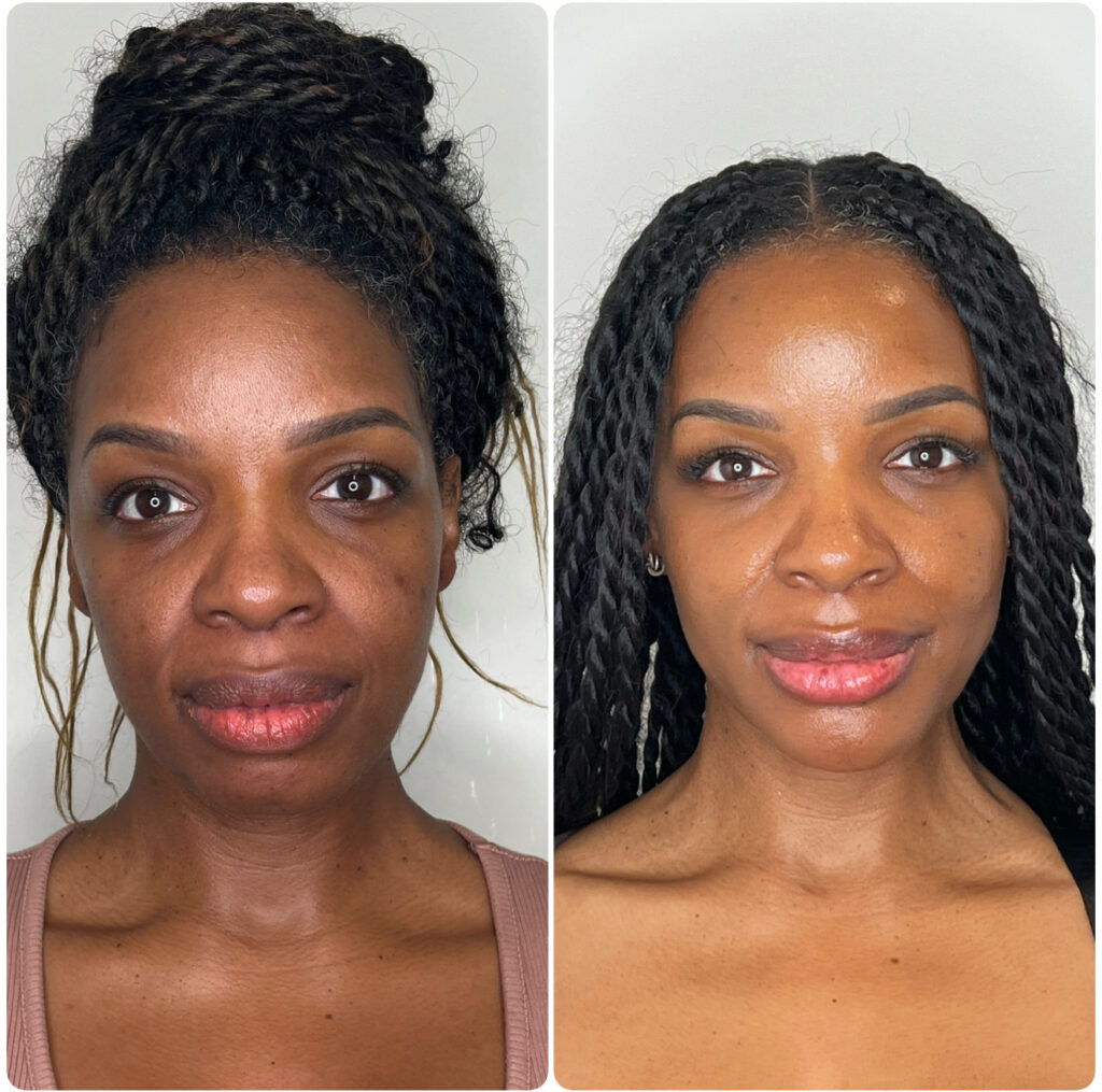 Before & aftetr