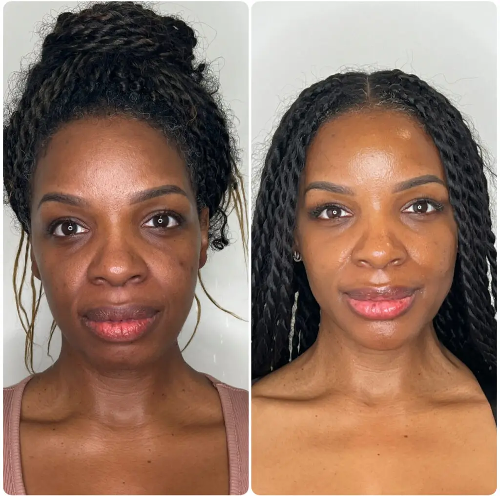 Before & aftetr