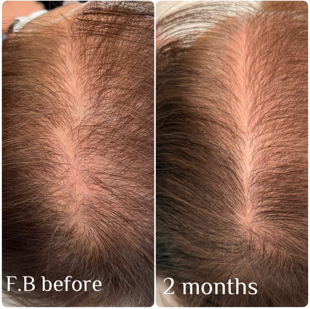 Before & aftetr