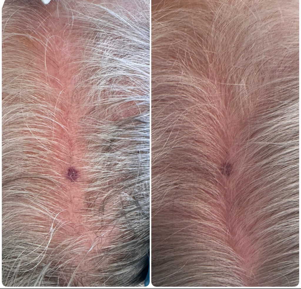 Before & aftetr