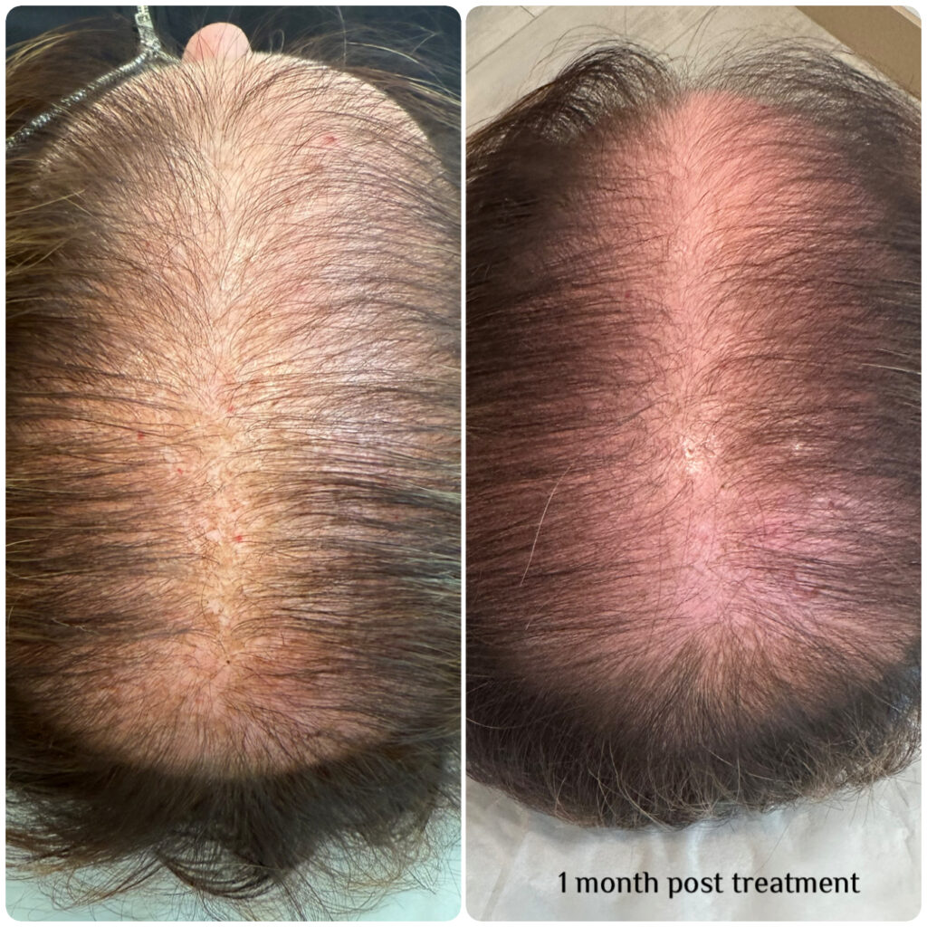 Before & aftetr