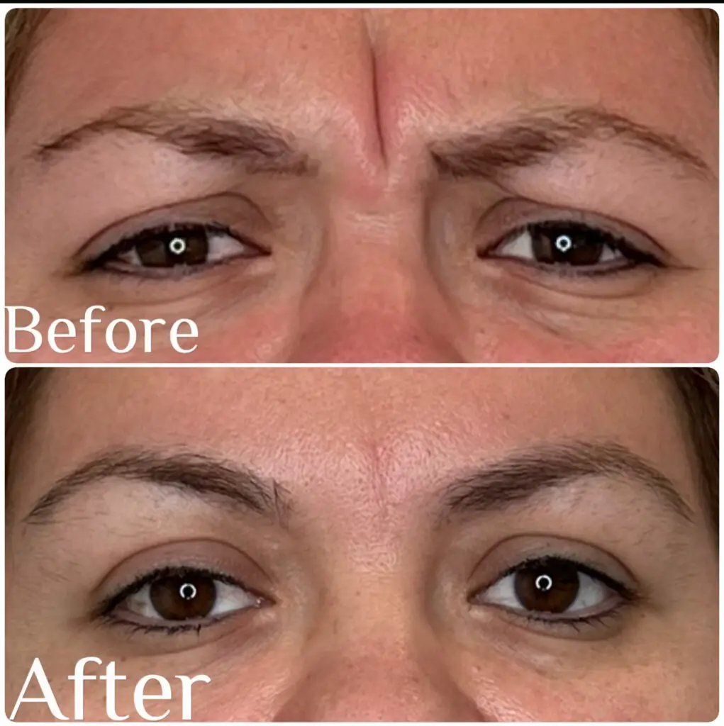 Before & aftetr