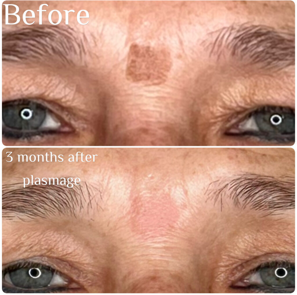 Before & aftetr