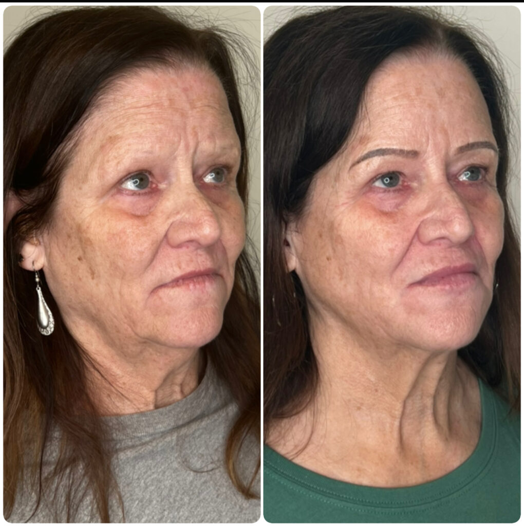 Before & aftetr