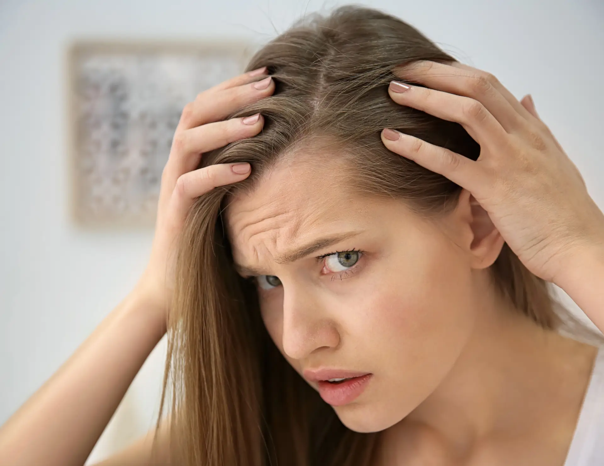 Hair Loss