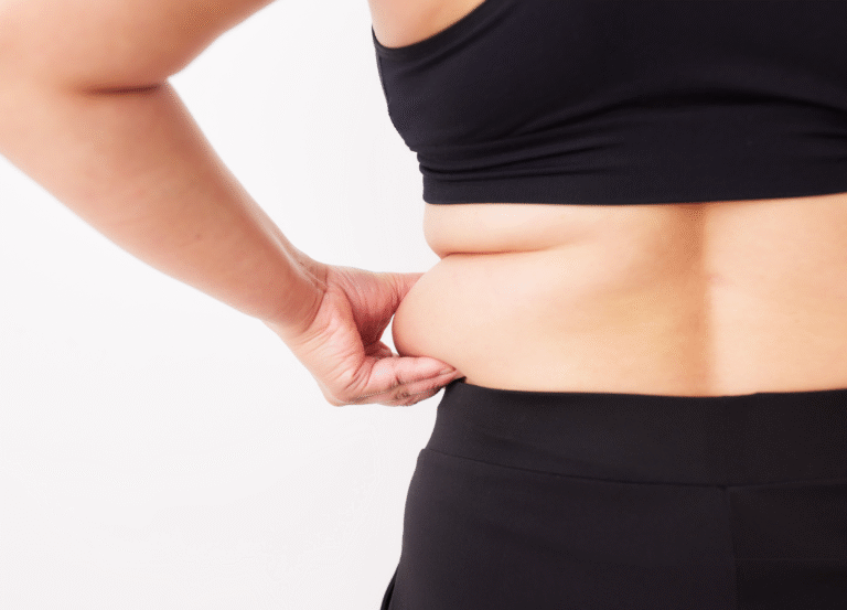 Fat Removal