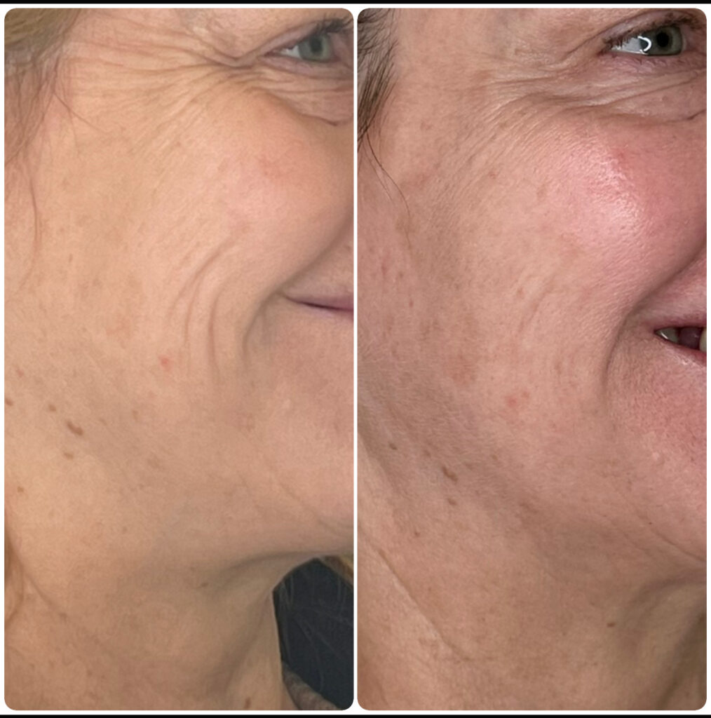 Before & After