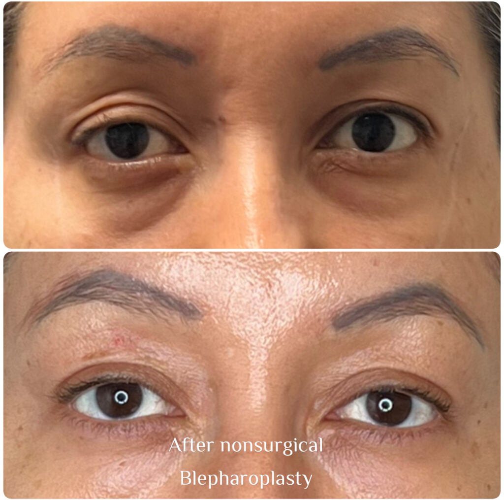 Before & After