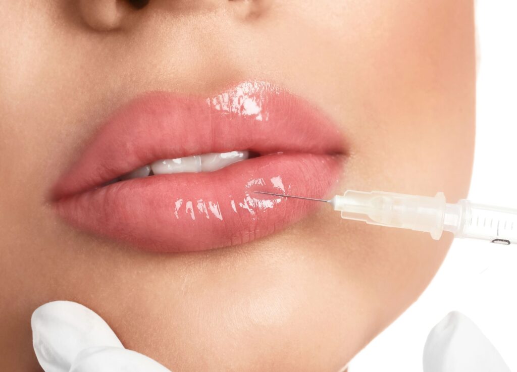 Lip Filler