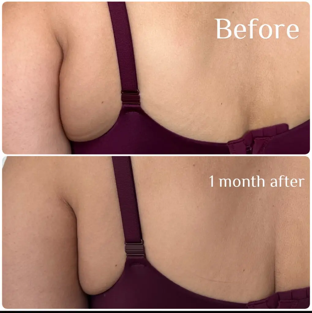 Before & After