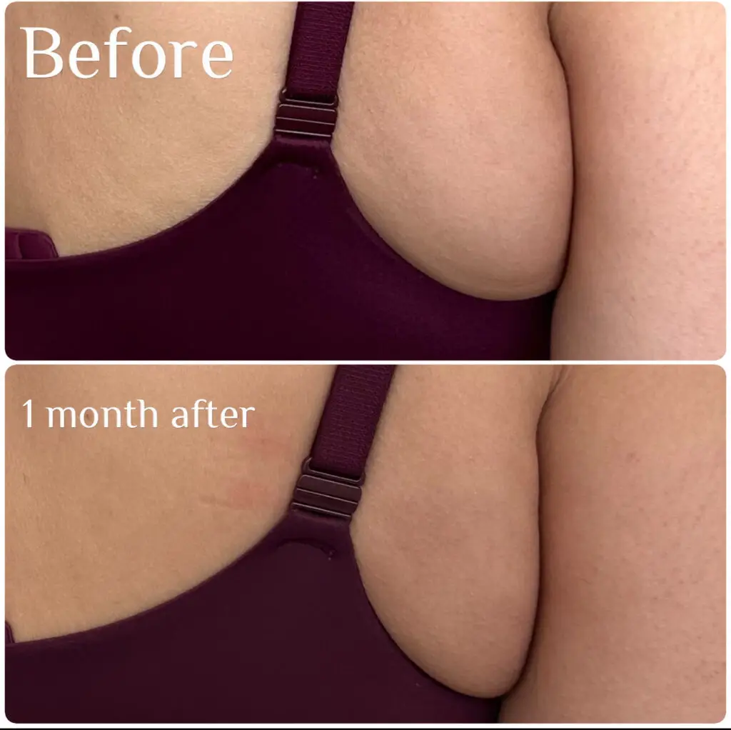 Before & After
