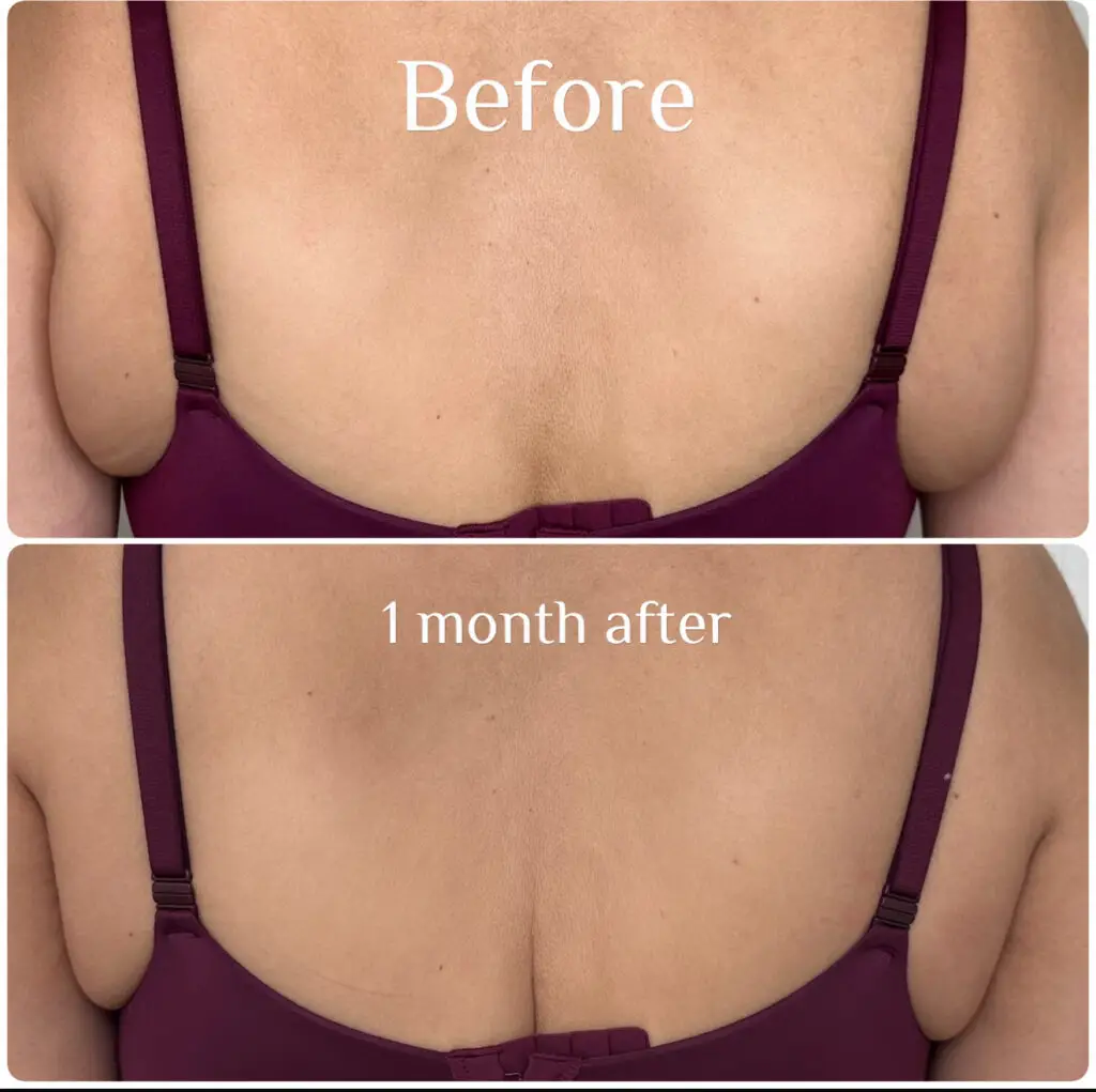 Before & After