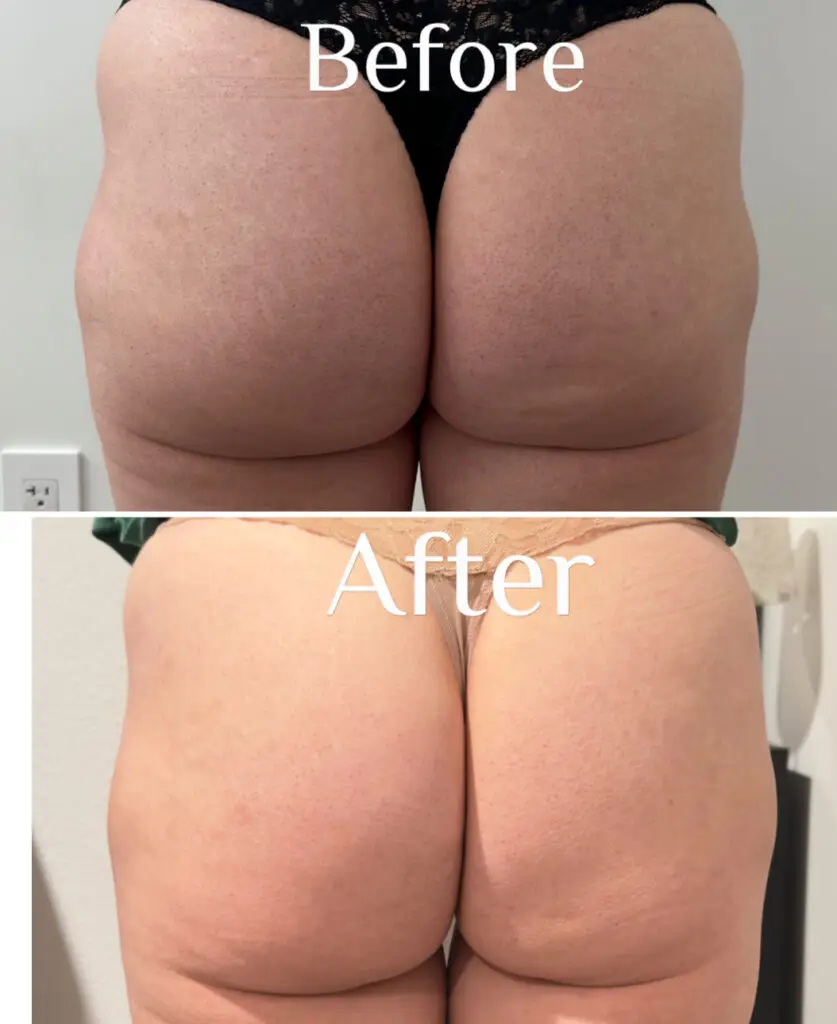 Before & After