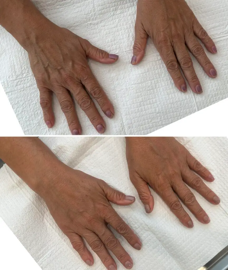 med spa in long beach