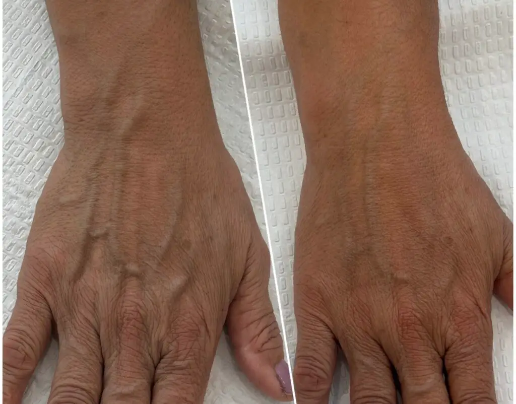 med spa in long beach
