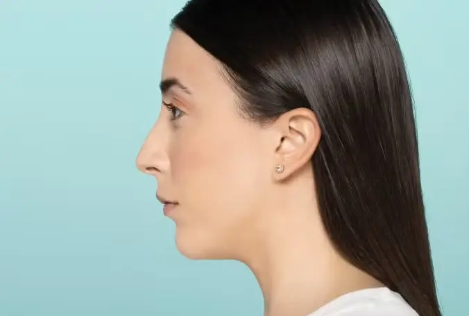 Restylane® Dermal Fillers in Long Beach, CA
