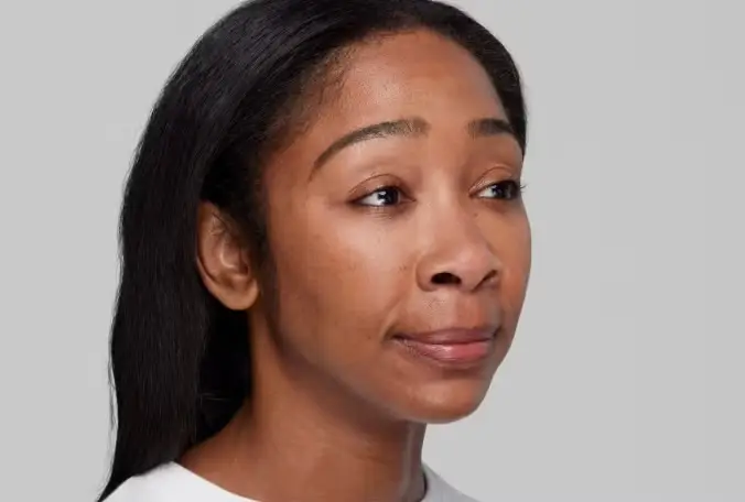 Restylane® Dermal Fillers in Long Beach, CA